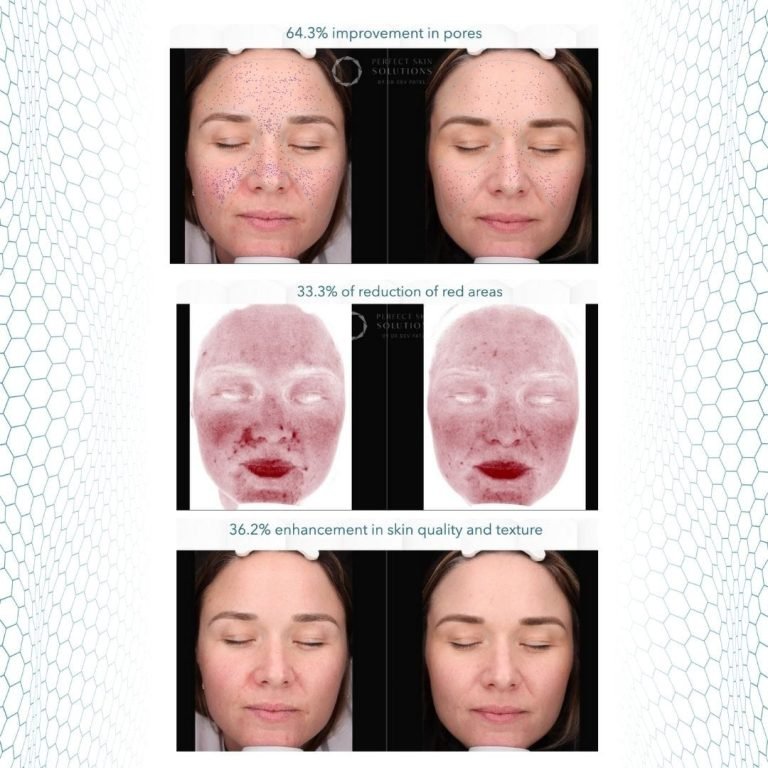 GF5 Next Generation® - Image 4