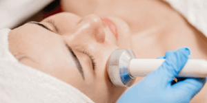 Face tightening in Edgware