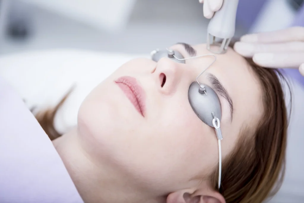 CO2 laser treatment in Greenford