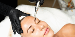 microneedling harrow