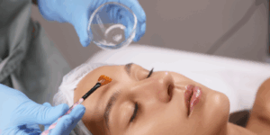 Medical facials in Harrow on the Hill