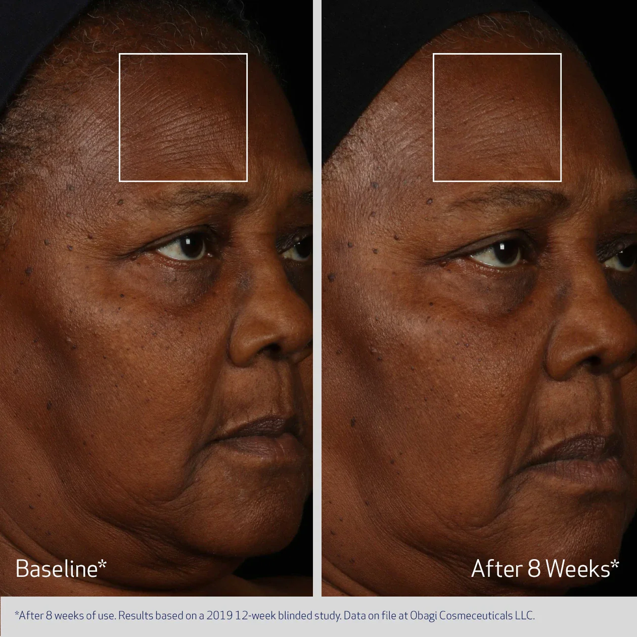 Elastiderm Facial Serum - Image 2
