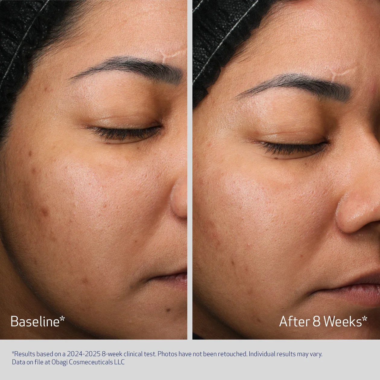 OBAGI RETINOL RETINOL + PHA - Image 2