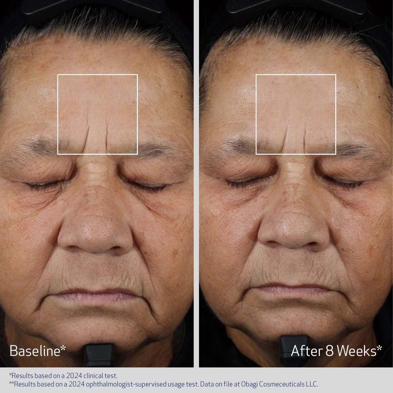 ADVANCED FILLER CONCENTRATE - Image 3