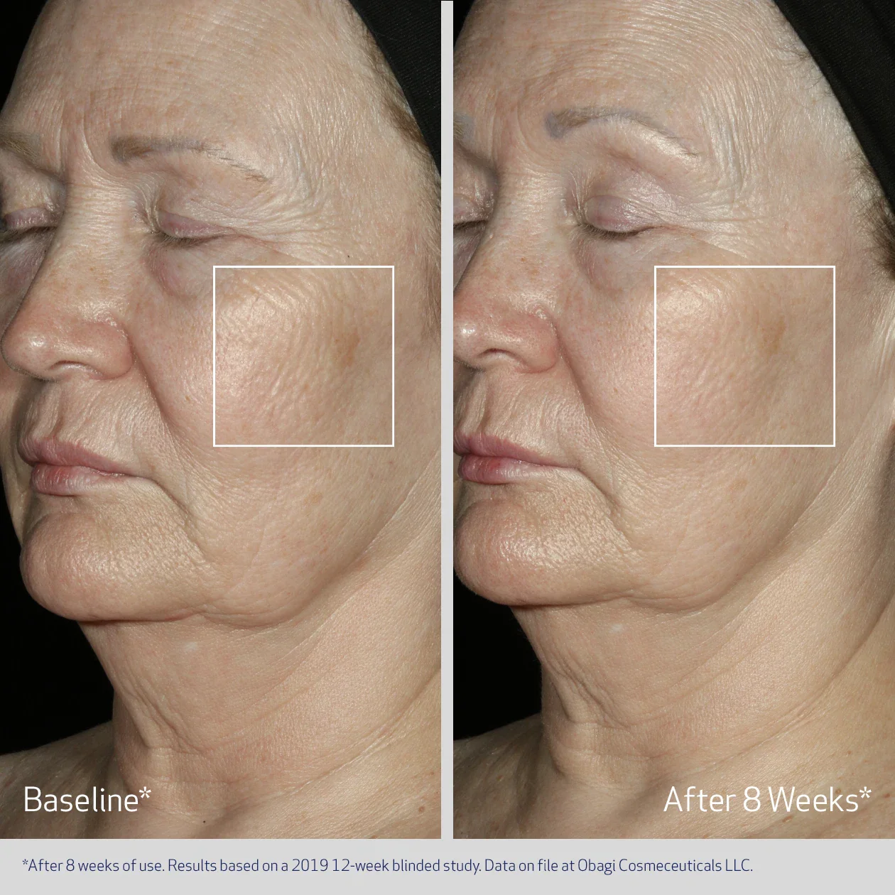 Elastiderm Facial Serum - Image 3