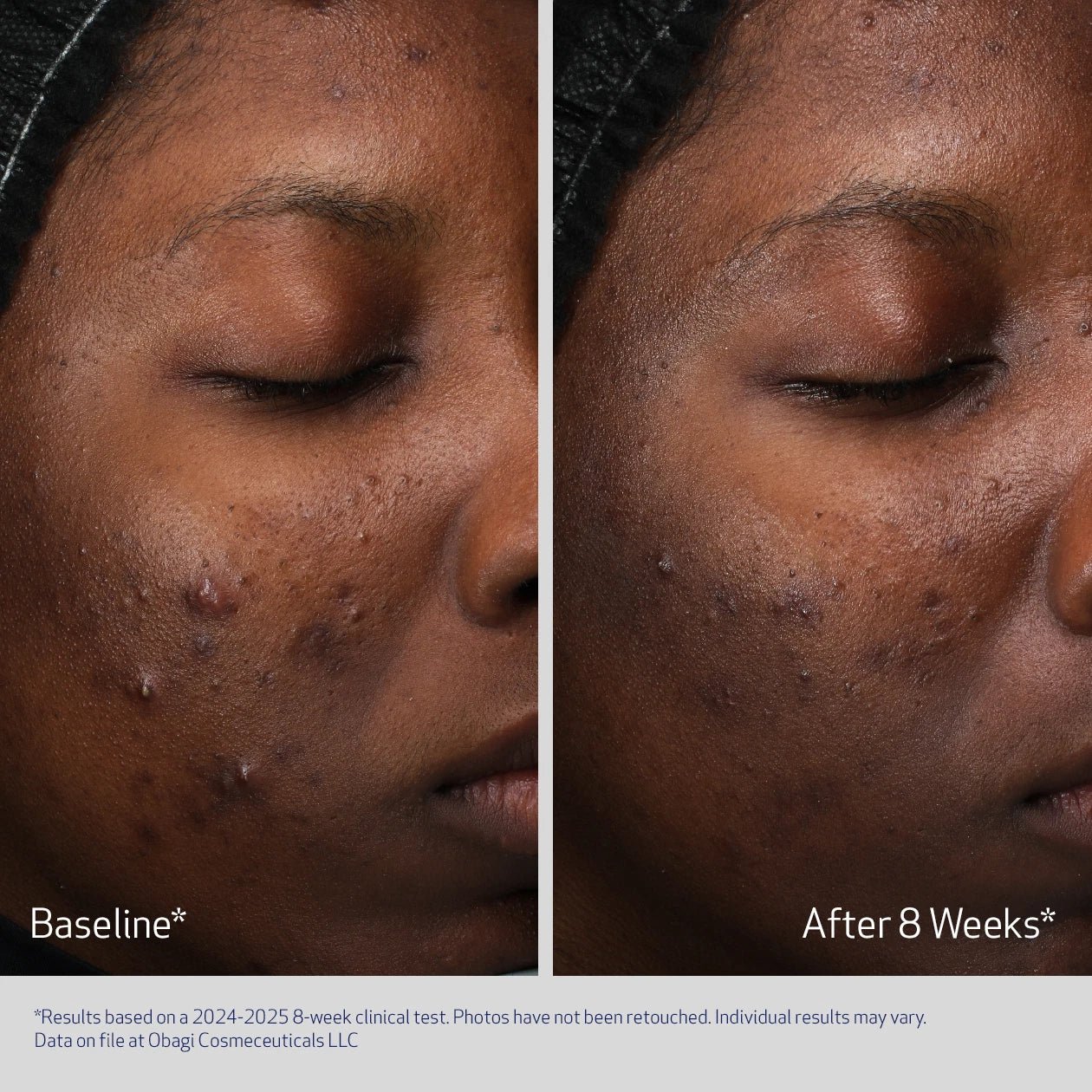 OBAGI RETINOL RETINOL + PHA - Image 3