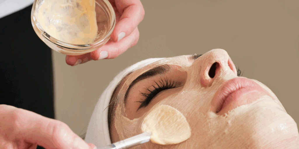 Melasma Treatment in Ealing