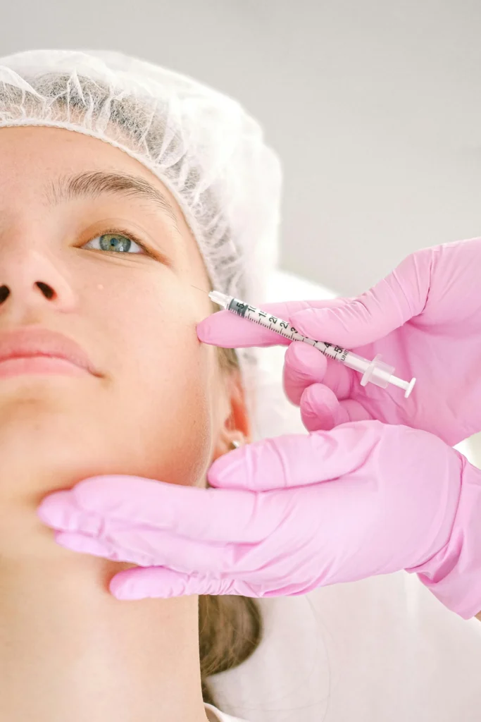 Microneedling in Edgware