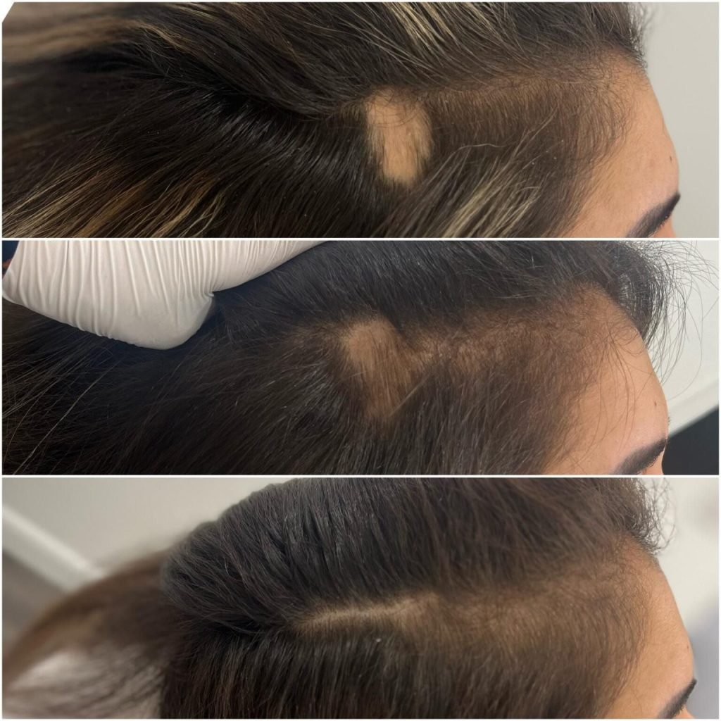 Regenerative Treatments in Ruislip