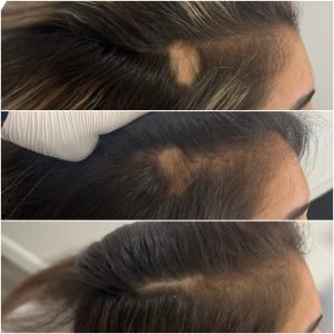 Regenerative Treatments