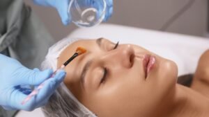 chemical-peeling-Medcura-Clinic